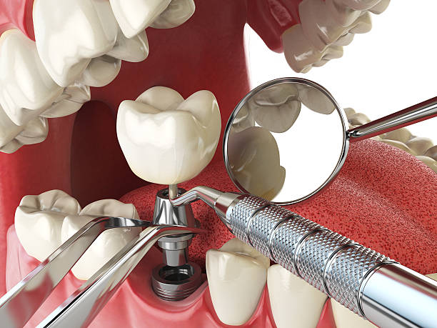 Best Weekend Emergency Dentist in Appleton, WI